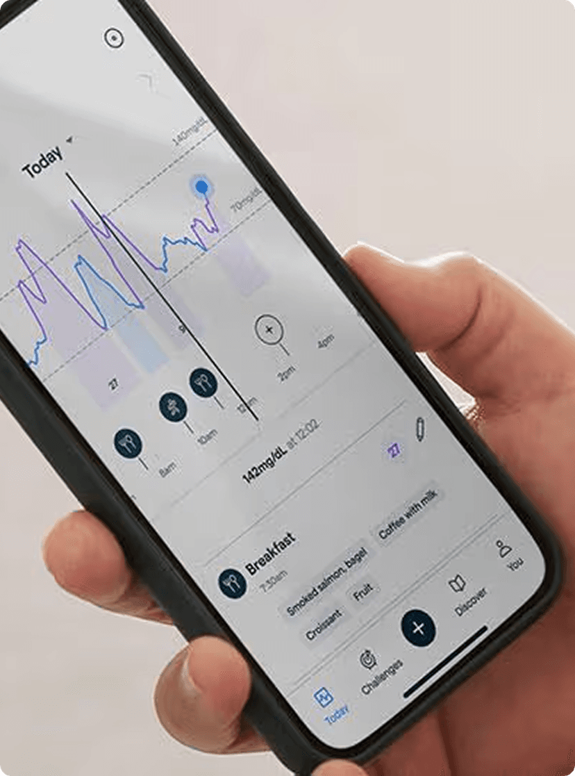 What is a CGM? How it works and how to apply one