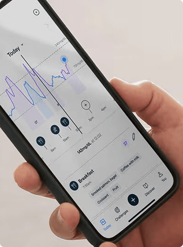 What is a CGM? How it works and how to apply one
